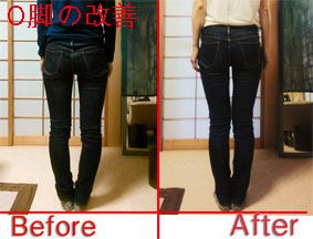 ビフォーアフター