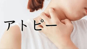 アトピー